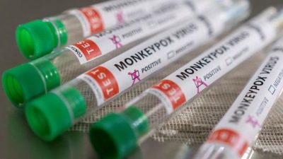 Kemkes Ungkap 5 Gejala Cacar Monyet, Minta Warga Lapor Jika Bergejala