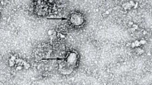 Studi: Virus Corona Bisa ‘Terbang’ Sampai 4 Meter